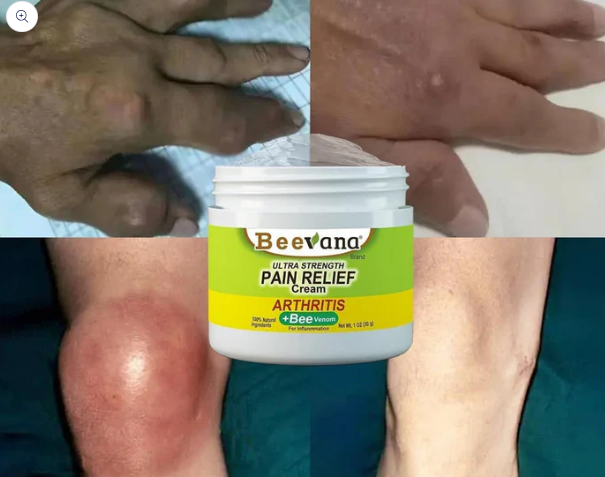 Bee Venom Joint And Bone Therapy Cream - BUY 1 GET 1 FREE